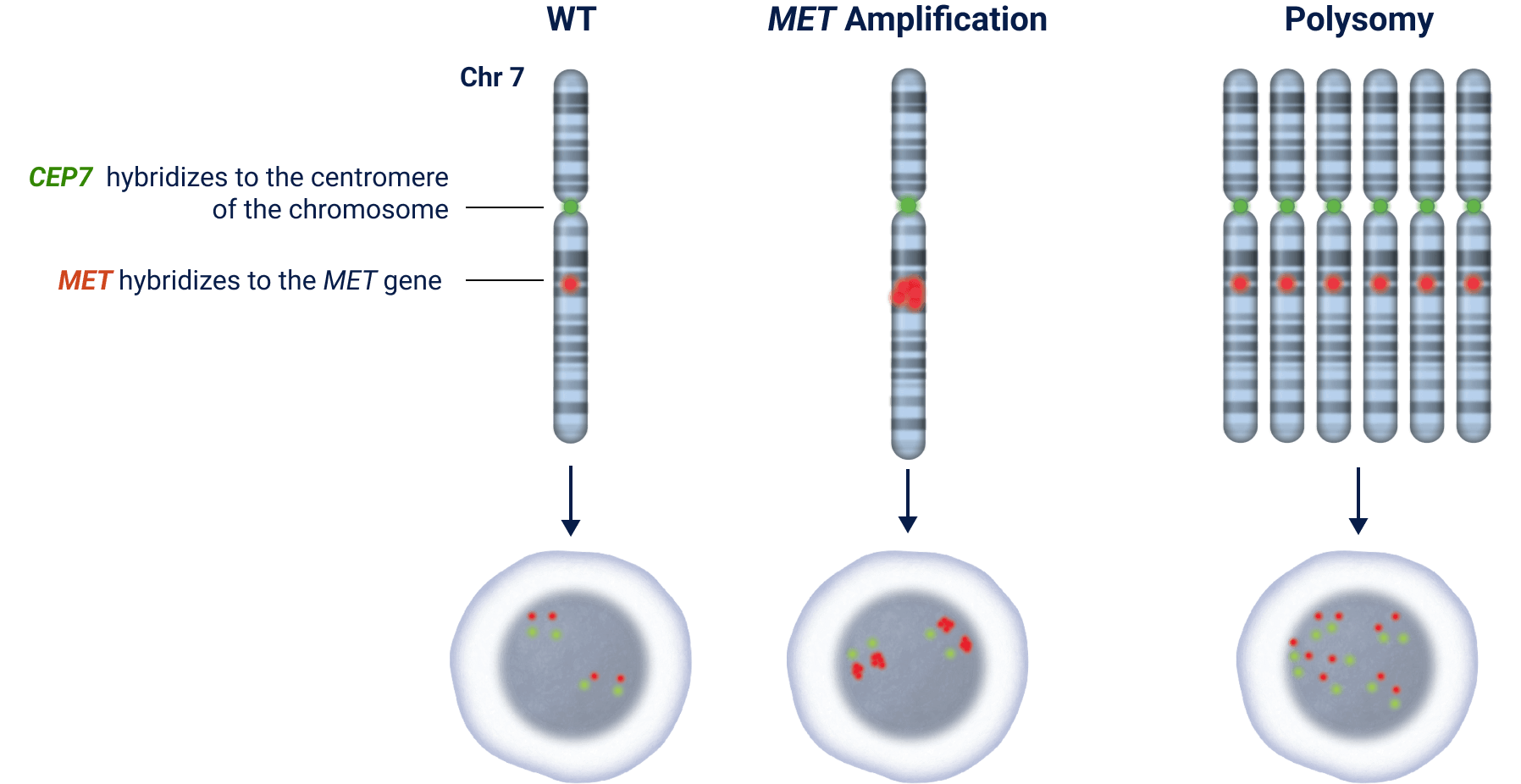 FISH MET Gene Amplification